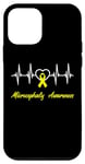 Coque pour iPhone 12 mini Ruban jaune pour sensibilisation à la microcéphalie Love Heartbeat