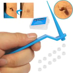 Beauty & Health Skin Tag Remover Skin Tag Removal Kit Mole Wart Tool Face Care