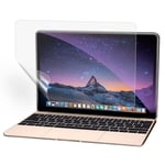 MacBook Pro 13' Retina High Transparency -näytönsuoja