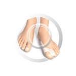 RUCK® Avlastning - 1 st - Effektivt skydd mot hallux valgus