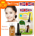 TEA Face Care Remove Acne Essential Oil Care Acne Scar Removal oil, Acne oil