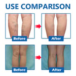 3pcs 0.7oz Leg Vein Care Cream Plant Extract Leg Swelling Relief Varicose Ve SG5