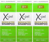 Medicated Shampoo Treatment for Dandruff, Psoriasis, Itchy Scalp (3 x 300ml)