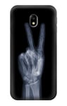 X-ray Peace Sign Fingers Case Cover For Samsung Galaxy J3 (2017) EU Version