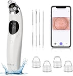 GUPAY Blackhead Remover Vacuum, Pore Vacuum with 1080p HD Camera Visible Facial