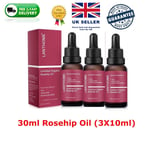 Rosehip Oil Certified Organic 100% Cold Pressed Pure Rose Hip Best Facial Oil