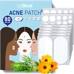 LitBear Acne Pimple Spot Patches for Large Zit Breakouts, Acne Patches for Face, Chin or Body, Acne Spot Treatment with Tea Tree & Calendula Oil, Hydrocolloid (80 Patches)