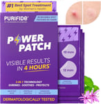 Purifide by Acnecide Power Pimple Patches, 36 Invisible Spot Patches with Salic