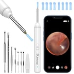 VITCOCO Ear Wax Removal Kit, 1920P HD Ear Cleaner with Camera Ear Wax Remover Tool, WiFi Otoscope with 6 LED Lights & 8 Ear Spoons, Visual Ear Scope for iPhone iPad Android Adults Kids Pets