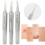 Professional Acne Extractor Tool Blemish Pimple Popper Tool Blackhead Remover