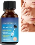 Wart Remover Fast Acting and Painless Skin Tag,Skin Tag Remover Liquid,Tags and