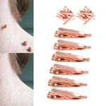 Skin Tag Remover Clips Safe Copper Smooth Skin Tag Removal Tool For Face FST