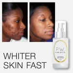 PURE WHITE WHITENING FACE SERUM FAIRER LIGHTER SKIN FADES ACNE SCARS MELASMA