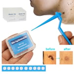 Rubber Bands Skin Tag Remover Mole Wart Tool Face Care Skin Tag Removal Kit