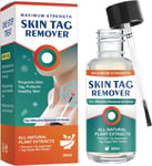 Skin-Tag-Remover-Kit, Mole & Wart-Remover Liquid, Fast-Acting Skin-Tag-Remover &