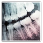 2 x Square Stickers 7.5 cm - Dental Teeth X-Ray Dentist Dental Cool Gift #21453