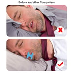 80 Counts Mouth Tape For Sleeping Breathable I Shaped Sleeping Mouth Tape