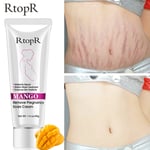  40g RtoprR Mango Pregnancy Stretch Scars Marks Remove Cream Treatment UK-SELLER