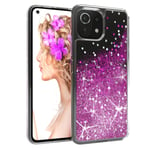 EAZY CASE for Xiaomi Mi 11 Lite/5G/5G New Glitter Case Phone Case