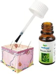 Mole & Wart Remover from Medosan Thuja Skincare, Growths & Skin Tag Removal