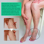 Varicose Veins Cream Relax Muscles Activate Collaterals Varicose Vein Cleans RHS