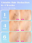 Wavytalk Laser Hair Removal Device,Painless Ice Cooling IPL Hair Removal,Max 24J