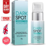 Dark Spot Remover for Face Age / Liver Spots Corrector Freckles & Skin Whitening