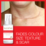 NEUTRA FADE SKIN RECOVERY OIL SCAR FADING OIL – GETS RID OF SCARS AND MARKS