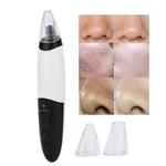 Electric 3-In-1 Blackhead Pore Cleaner Vacuum Suction Face Care Devices SLS