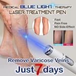 Blue Light Therapy Acne Laser Pen Soft Scar Wrinkle Removal Treatment Machine