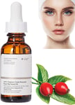 100% Organic Rose Seed Oil,Cold-Pressed Rose Hip Oil,Rosehip Oil for Face,Facial