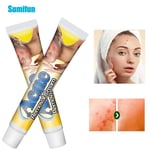 Acne Removal Cream Pimple Pits Pustule Ointment Deep Cleaning Face Repair Skin