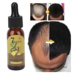 Ginger Hair Growth Serum Deep Nourishing Repair Hair Root Hair Regrowth Cari TDM