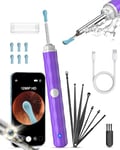 Ear Wax Removal Camera, Kekoy Ear Cleaner 1296P HD Camera, Ear Cleaning Kit with 8pcs Ear Set, Wireless WiFi Otoscope with 6 Lights, Rechargeable Earwax Removal Tool Kit for Adult & Kid(Light Purple)