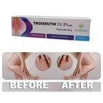 Troxerutin Varicose Spider Veins Cream Vasculitis Legs Treatment Gel Troxevasin