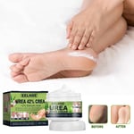 Urea Cream 42% Plus 2% Salicylic Acid Callus Remover Hand Cream Foot Cream UK