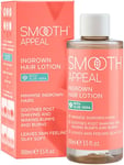 Smooth Appeal Ingrown Hair Lotion - The Ultimate Solution for Silky Smooth,