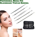 Pimple Popper Blackhead Remover Kit 5 Pcs Tool Extractor Comedone Acne Spot UK