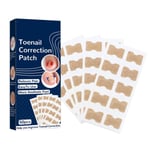 50 st Ingrown Toenails Patch Sticker Tånagel Patch Corrector Pedikyr Verktyg Ingrown Tånagel Korrigering Patch för Kvinnor Män