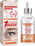 Milia Remover, Milia Serum for Face, Milia Spot Serum Helps to Ruduce Milia, for