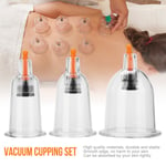 12pcs U-shape Cups Chinese Vacuum Cupping Set Massage Therap