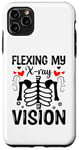 Coque pour iPhone 11 Pro Max Flexing My X-Ray Vision Radiologiste Radiologiste Rad Tech