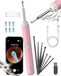 Ear Wax Removal Camera, Kekoy Ear Cleaner 1296P HD Camera, Ear Cleaning Kit with 8pcs Ear Set, Wireless WiFi Otoscope with 6 Lights, Rechargeable Earwax Removal Tool Kit for Adult & Kid(Pink)