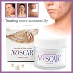 NOSCAR Cream Mother of Pearl Against All Scars & Stretch Marks No Scar 30ml UK