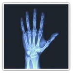 2 x Square Stickers 7.5 cm - Human Hand X-Ray Bones Doctor Nurse Science Cool Gi