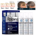 For Men Extra Strength Hair Loss & Hair Growth Scalp Foam 60g * 3PCS -HOT