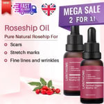 2 x 10ML 🌟 Rosehip Oil Certified Organic  Scars, Stretch Marks & Wrinkles ✅🔥