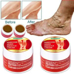 2pcs 10g Varicose Veins Ointment Vasculitis Phlebitis Spider Treatment Cream