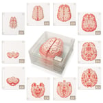 Anatomic Brain Specimen Coasters-presenter för medicinska studentpresenter Hjärndekor Mänsklig anatomi gåvor