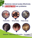 Folliculitis Shampoo, Seborrheic Dermatitis Shampoo, Anti Dandruff Shampoo, From